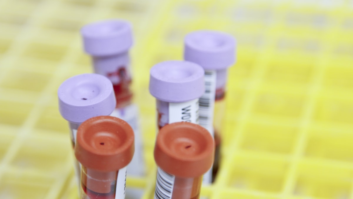 Aus dem Tumor eines einzelnen Patienten wird im Labor ein individueller mRNA-Impfstoff entwickelt, der dem Immunsystem beibringt, den Krebs anzugreifen.